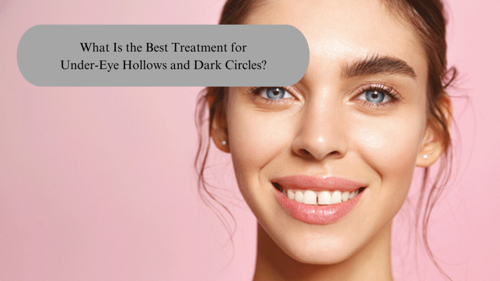 What Is the Best Treatment for Under-Eye Hollows and Dark Circles?
