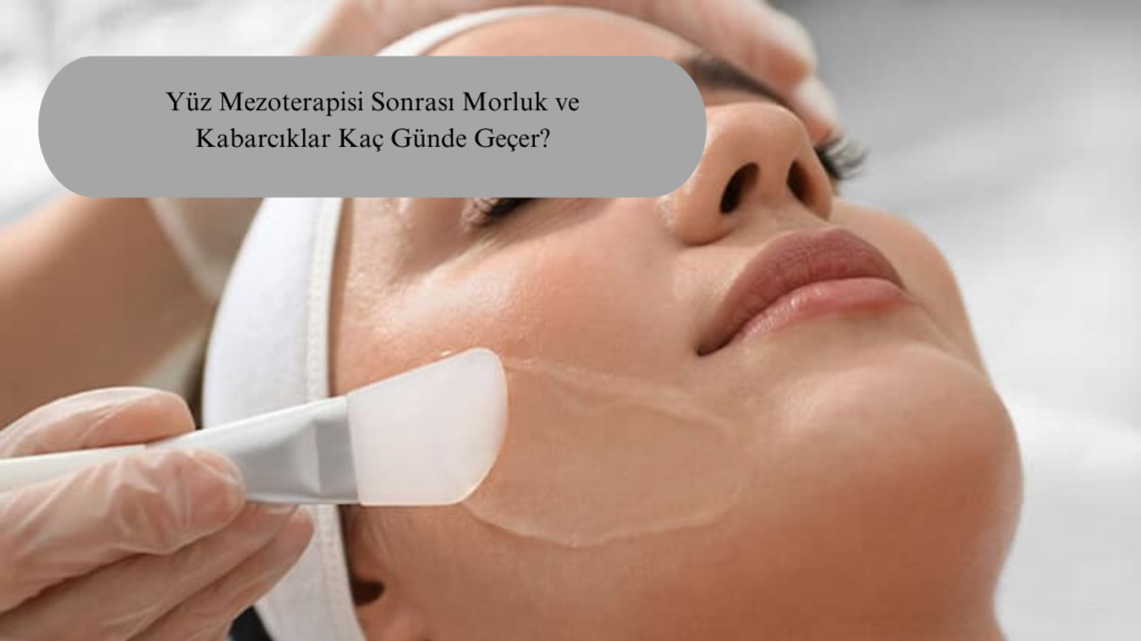 Yüz Mezoterapisi Sonrası Morluk ve Kabarcıklar Kaç Günde Geçer?